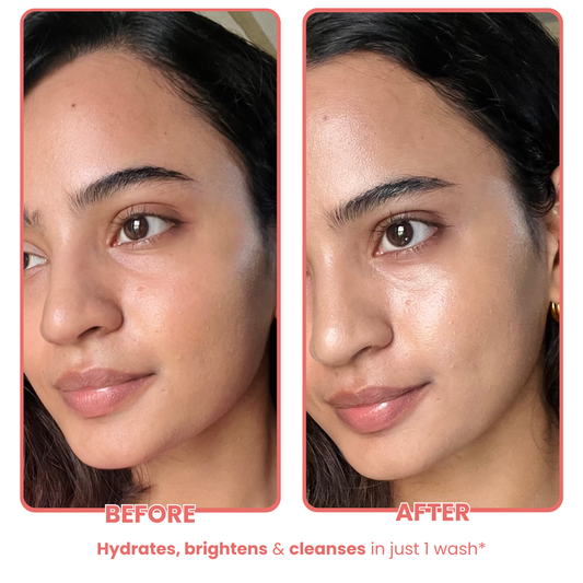 Watermelon Facewash for Clear & Glowy Skin