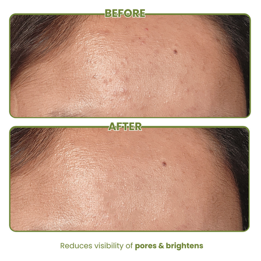 Matcha Green Tea Toner for Pore Clarification