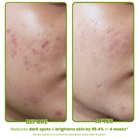 Avocado Serum with Hyaluronic & Squalane - 30ml - Test