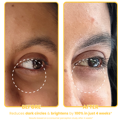 Banana Under-Eye Cream for Dark Circles & Dry Eyes