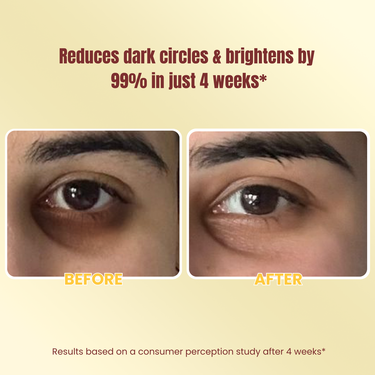 Banana Under-Eye Cream for Dark Circles & Dry Eyes
