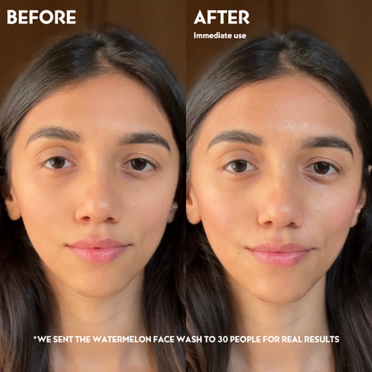 Free - Watermelon Facewash for Clear & Glowy Skin (30ml)